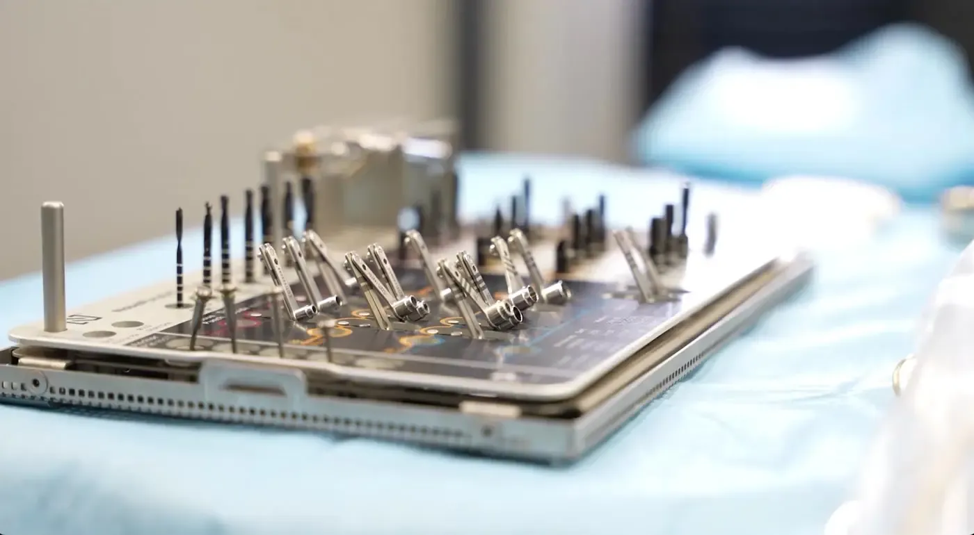 Dental implant timeline: from first scan to final crown
